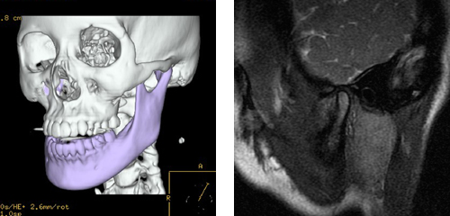 RD-CT  {֐MRI